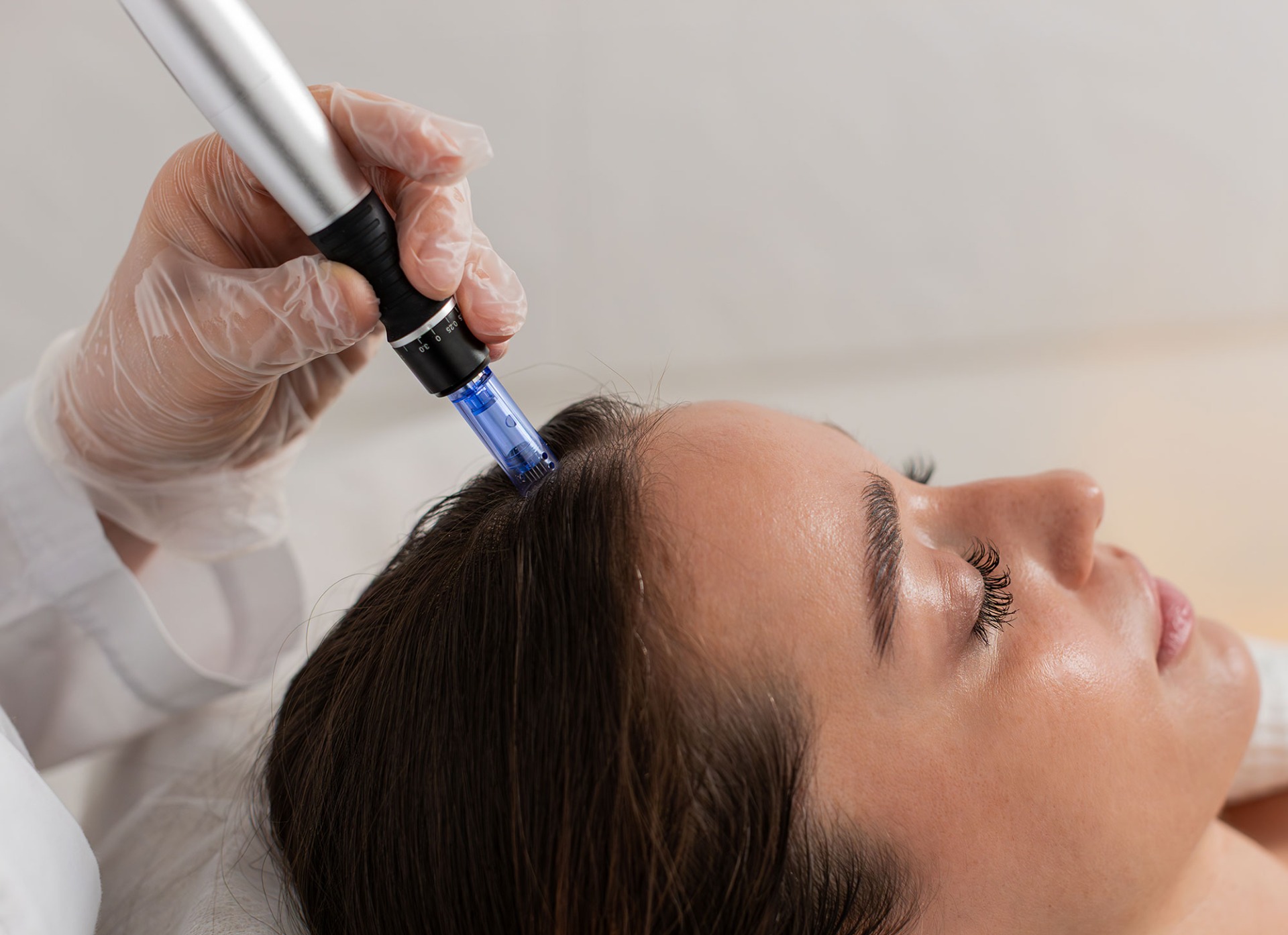Microneedling pentru scalp
